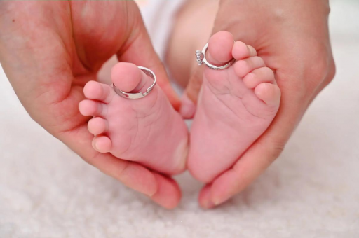 昭通孕妇怎样预防妊娠纹